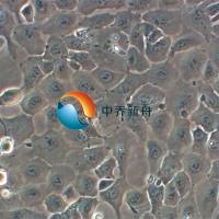 OV-1063人卵巢上皮细胞癌细胞