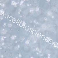 SKNO-1 人急性髓系白血病细胞/STR鉴定/镜像绮点(Cellverse)