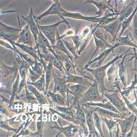 OCM1a人低侵袭性脉络膜黑色素素瘤细胞