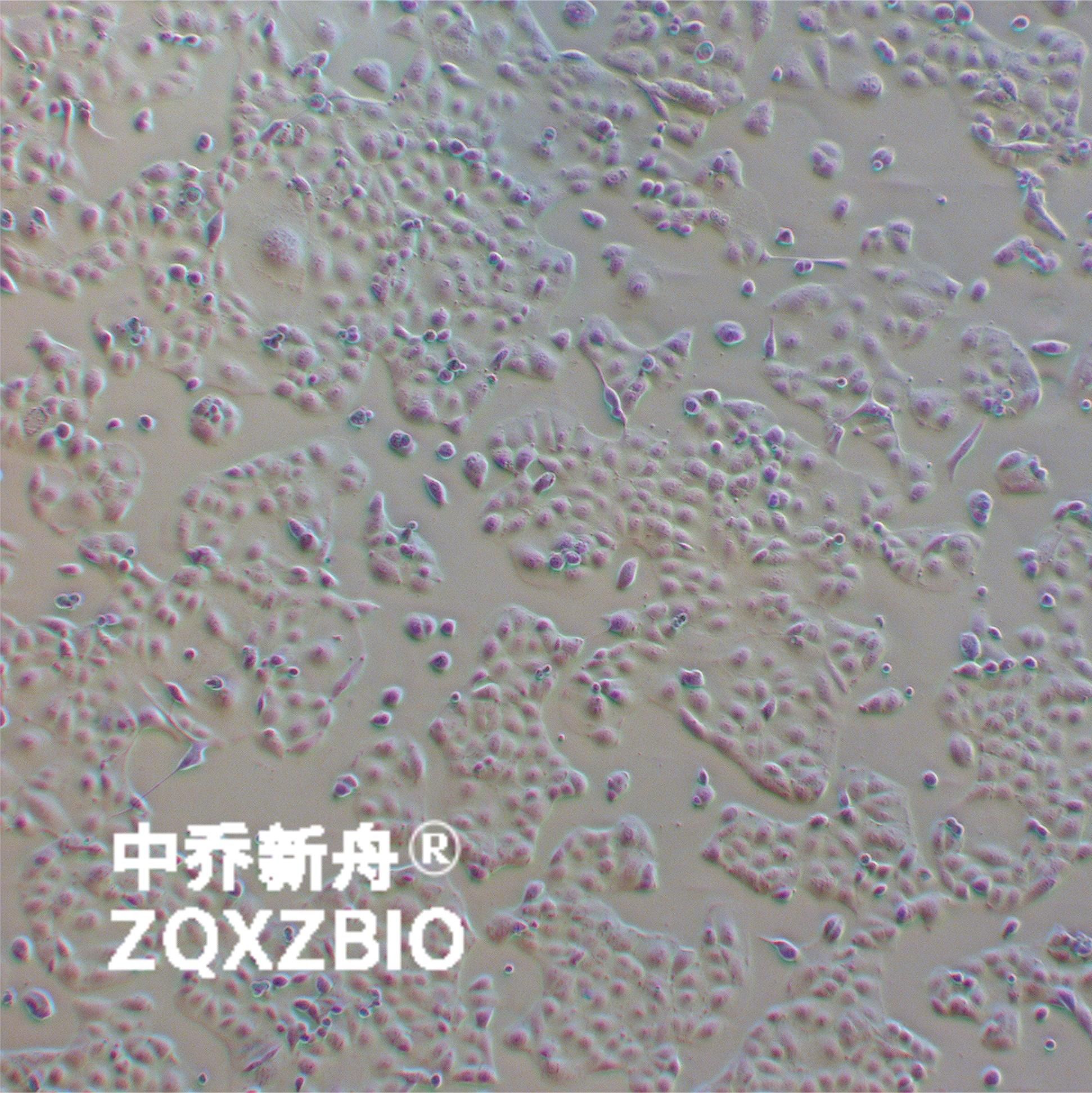 MKN-28人胃癌细胞