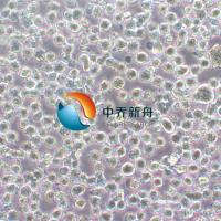 LP-1人多发性骨髓瘤细胞