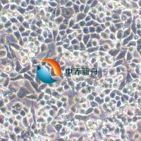 SK-UT-1B子宫内膜癌细胞