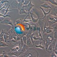 BT-20人乳腺癌细胞