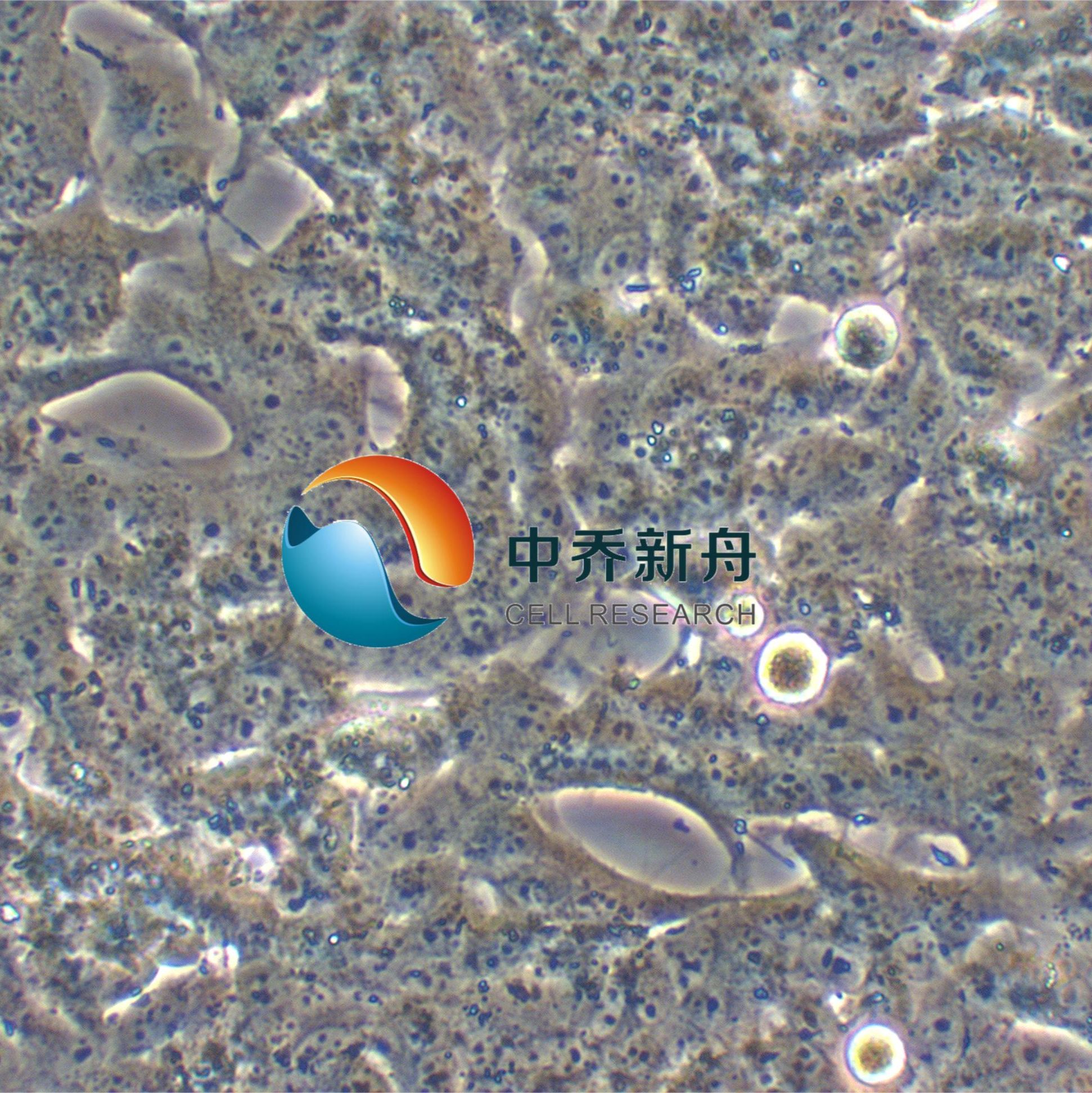 BE(2)-M17人神经母细胞瘤细胞