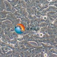 BE(2)-M17人神经母细胞瘤细胞