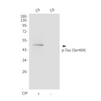 Anti-Tau phospho S404)