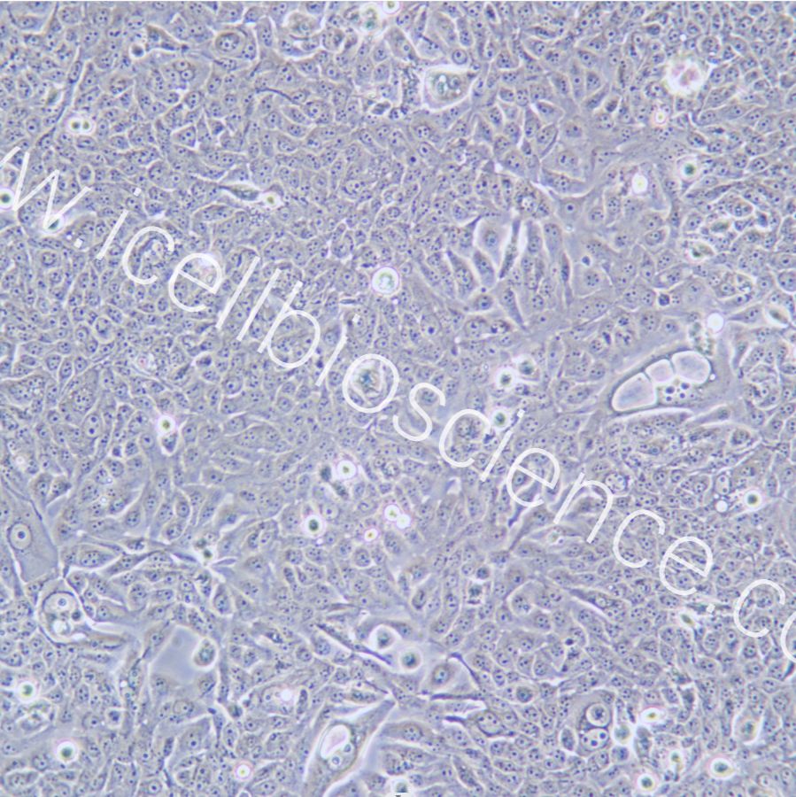 JIMT-1 人乳腺癌细胞/STR鉴定/镜像绮点（Cellverse）
