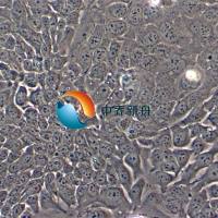 NCI-H747人结肠直肠腺癌细胞