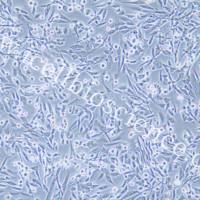 HS-5细胞 | HS5细胞 | HS-5 | HS5 | 人骨髓基质细胞 | STR鉴定 | 镜像绮点(Cellverse)