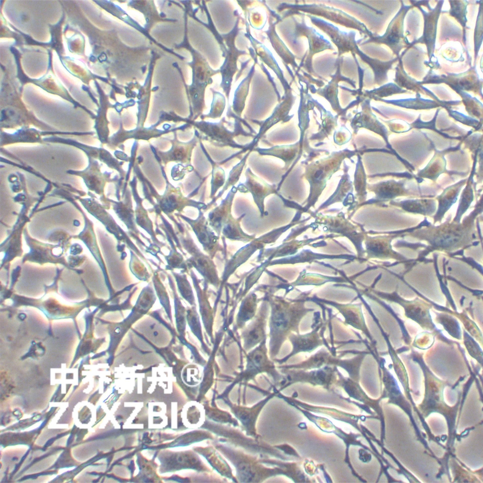 MLO-Y4小鼠骨样细胞