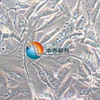 SK-MEL-28人恶性黑色素瘤细胞