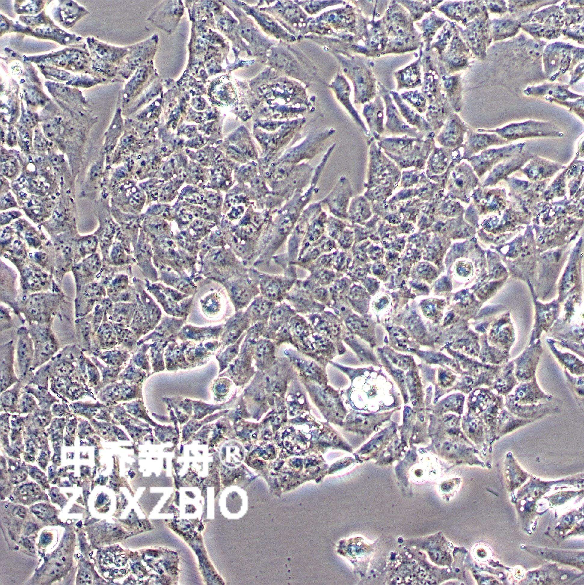 Caki-2人乳头状肾细胞癌细胞