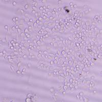 成年小鼠关节软骨细胞原代培养