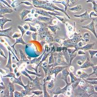 UPCI-SCC-090人舌头鳞癌细胞