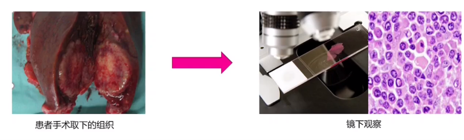 【技术干货 】病理切片不容易，绝世刀法还需练；选对刀片，成功一半