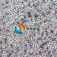 OCI-AML2人急性髓系白血病