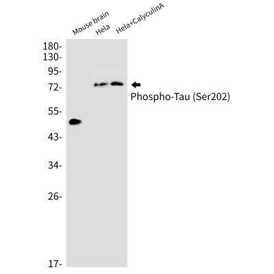 Anti-Tau (phospho S202)