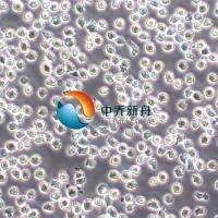 NALM6 B系急性淋巴细胞白血病细胞