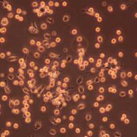 大鼠骨髓来源的内皮祖细胞体外培养