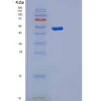 人突触囊泡蛋白Ⅺ(SYT11)重组蛋白