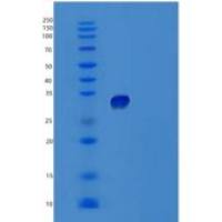 人TNFRSF6B重组蛋白