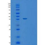人TATDN1重组蛋白