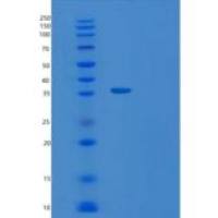 人TATDN1重组蛋白