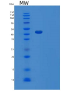 人肿瘤坏死因子受体超家族成员14(TNFRSF14)重组蛋白
