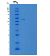 人TNFRSF1A关联Via死亡域蛋白(TRADD)重组蛋白