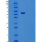 人肿瘤坏死因子受体超家族成员14(TNFRSF14)重组蛋白