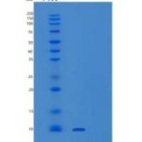人小泛素相关修饰蛋白2(SUMO2)重组蛋白