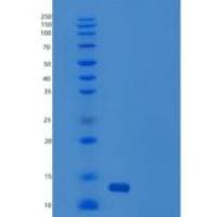 人线粒体输入内膜移位酶亚单位Tim8 A(TIMM8A)重组蛋白