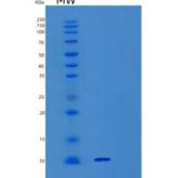 人Synaptobrevin 1重组蛋白