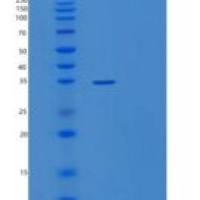 人硫酸酯酶修饰因子1(SUMF1)重组蛋白