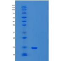 人α-突触核蛋白A30P重组蛋白