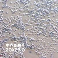 COR-L23 人肺癌细胞(大细胞肺 I 癌)