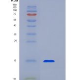人转化生长因子β1(TGFb1)重组蛋白
