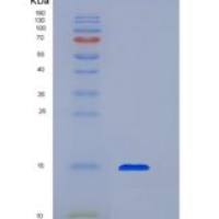 人转化生长因子β1(TGFb1)重组蛋白