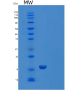 人推定的TGFB1诱导的抗凋亡因子1（TIA f1）重组蛋白