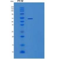 人转化生长因子β3(TGFb3)重组蛋白