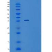 人TIPIN重组蛋白