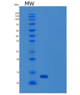 人线粒体输入内膜移位酶亚单位Tim8 A(TIMM8A)重组