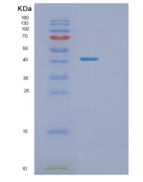 人原肌球调节蛋白3(TMOD3)重组蛋白