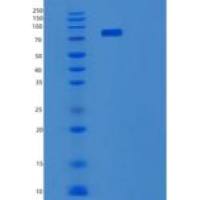 小鼠谷氨酰胺转胺酶2(TGM2)重组蛋白