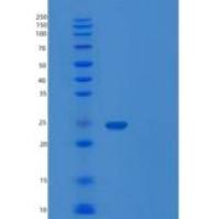 人转胶蛋白2(TAGLN2)重组蛋白