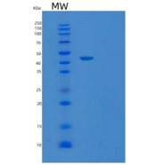 大肠杆菌TARDBP重组蛋白