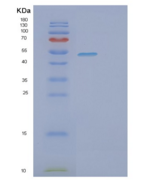 人亚硫酸盐氧化酶(SUOX)重组蛋白