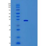 人Survivin重组蛋白