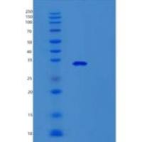 人Survivin重组蛋白