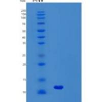 人联会复合体中心元件蛋白3（syc 3）重组蛋白
